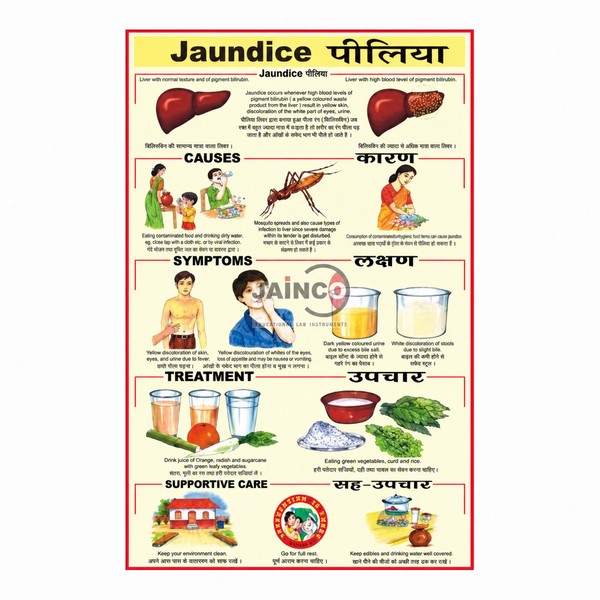 Jaundice Chart